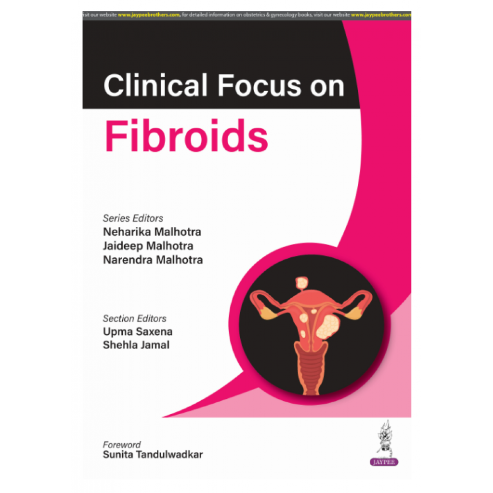 Clinical Focus on Fibroids;1st Edition 2025 by Neharika Malhotra, Jaideep Malhotra & Narendra Malhotra