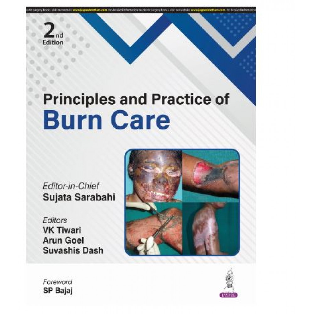 Principles and Practice of Burn Care;2nd Edition 2025 by Sujata Sarabahi, VK Tiwari, Arun Goel & Suvashis Dash