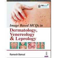 Image Based Mcqs In Dermatology  Venereology & Leprology:1st Edition 2024 By Ramesh Bansal