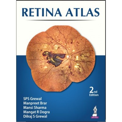 Retina Atlas:2nd Edition 2024 By SPS Grewal	& Manpreet Brar	& Mansi Sharma