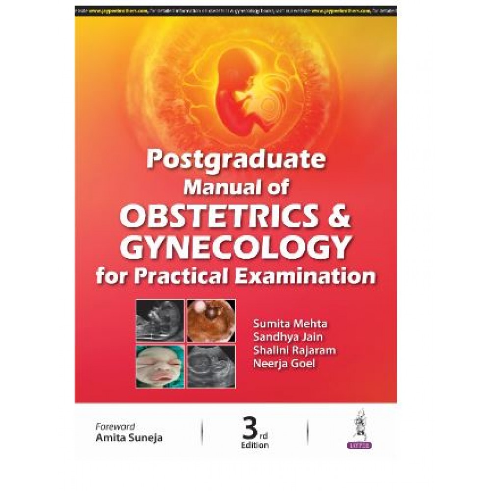 Postgraduate Manual of Obstetrics and Gynecology for Practical Examination;3rd Edition 2024 by Sumita Mehta, Sandhya Jain & Shalini Rajaram