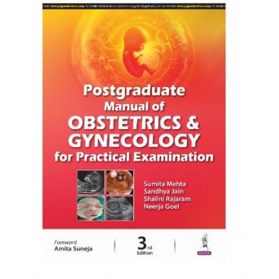 Postgraduate Manual of Obstetrics and Gynecology for Practical Examination;3rd Edition 2024 by Sumita Mehta, Sandhya Jain & Shalini Rajaram