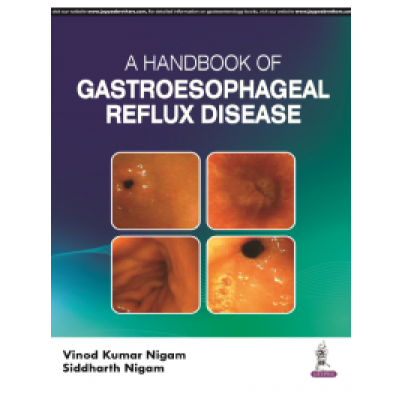 Handbook of Gastroesophageal Reflux Disease;1st Edition 2024 by Vinod Kumar Nigam & Siddharth Nigam