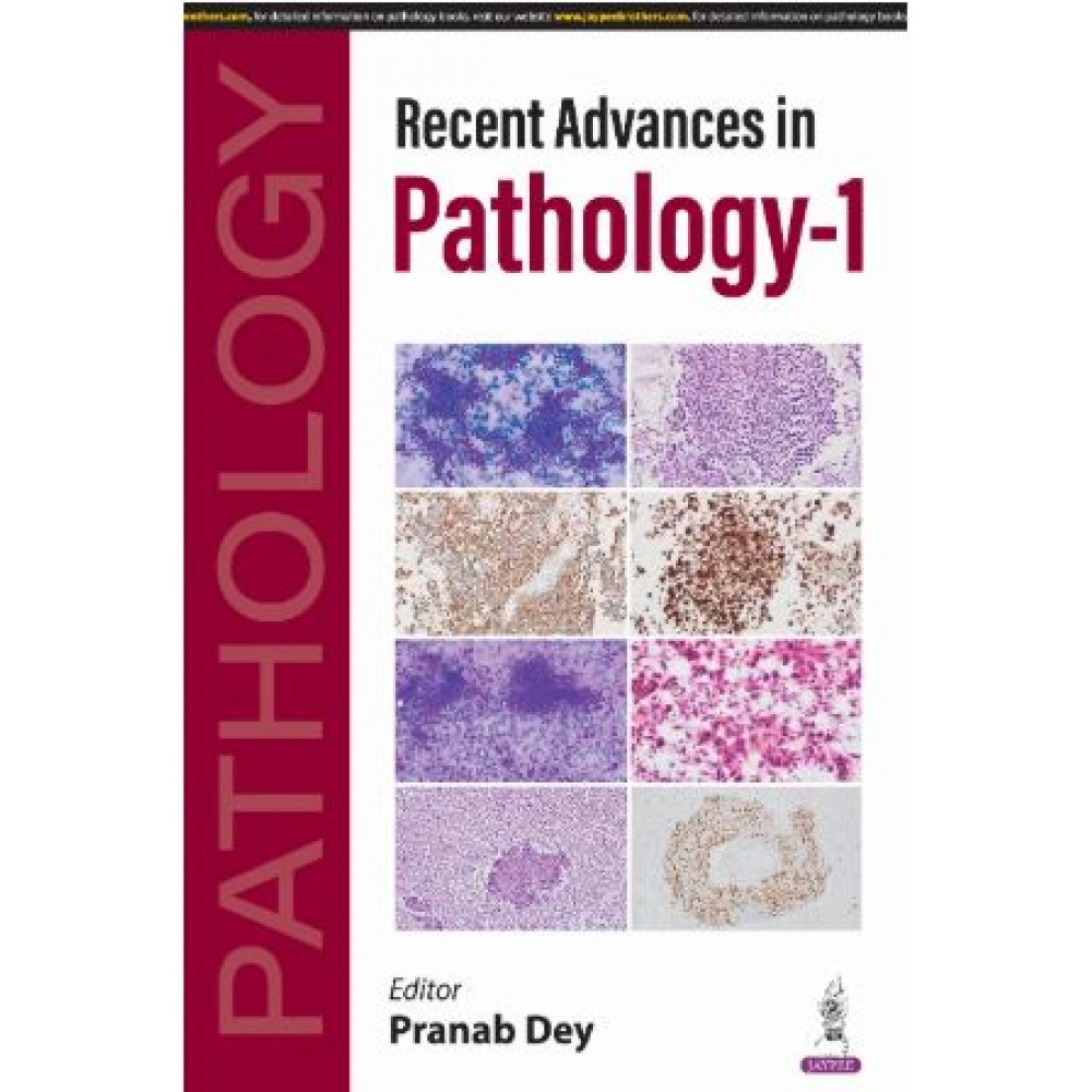 Recent Advances in Pathology-1:1st Edition 2025 By Pranab Dey