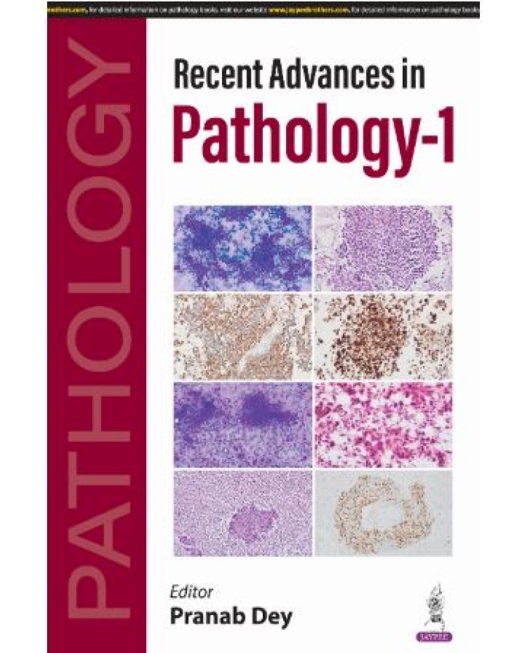 Recent Advances in Pathology-1:1st Edition 2025 By Pranab Dey