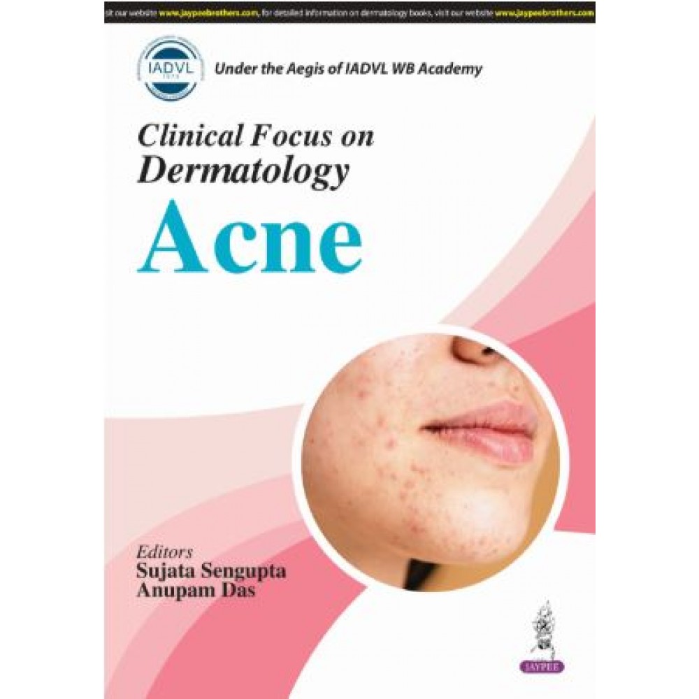 IADVL Clinical Focus on Dermatology Acne:1st Edition 2025 By Sujata Sengupta & Anupam Das