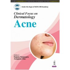 IADVL Clinical Focus on Dermatology Acne:1st Edition 2025 By Sujata Sengupta & Anupam Das