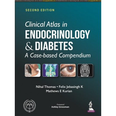 Clinical Atlas in Endocrinology & Diabetes;2nd Edition 2022 By Nihal Thomas, Mathews E Kurian & Felix Jebasingh K
