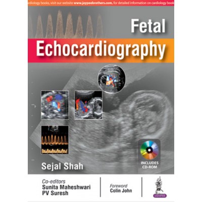 Fetal Echocardiography;1st Edition 2018 By Sejal Shah