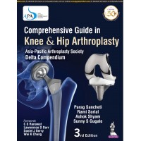 Comprehensive Guide in Knee & Hip Arthroplasty:Asia Pacific Arthroplasty Society-Delta Compendium;3rd Edition 2019 By Parag Sancheti