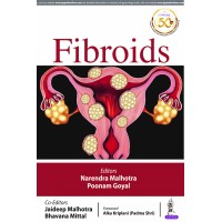 Fibroid;1st Edition 2020 By Narendra Malhotra & Poonam Goyal