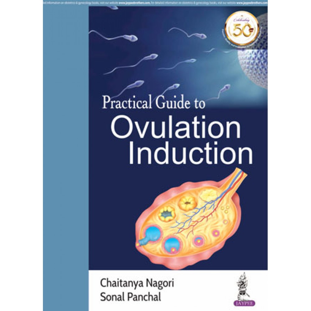 Practical Guide to Ovulation Induction;1st Edition 2019 By Chaitanya Nagori