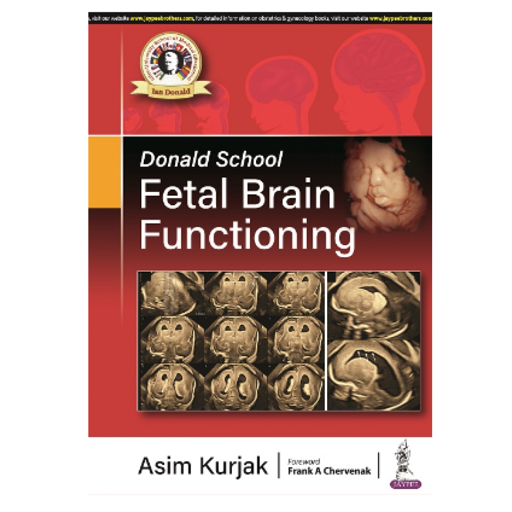 Donald School Fetal Brain Functioning;1st Edition 2022 By Asim Kurjak