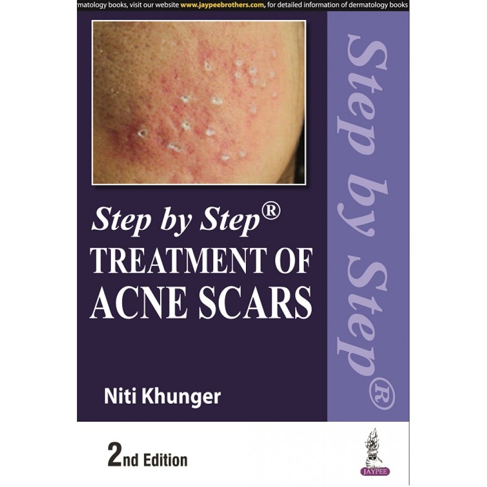 Step By Step Treatment Of Acne Scars; 2nd Edition 2022 by Niti Khunger