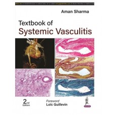 Textbook of Systemic Vasculitis;2nd Edition 2023 By Aman Sharma