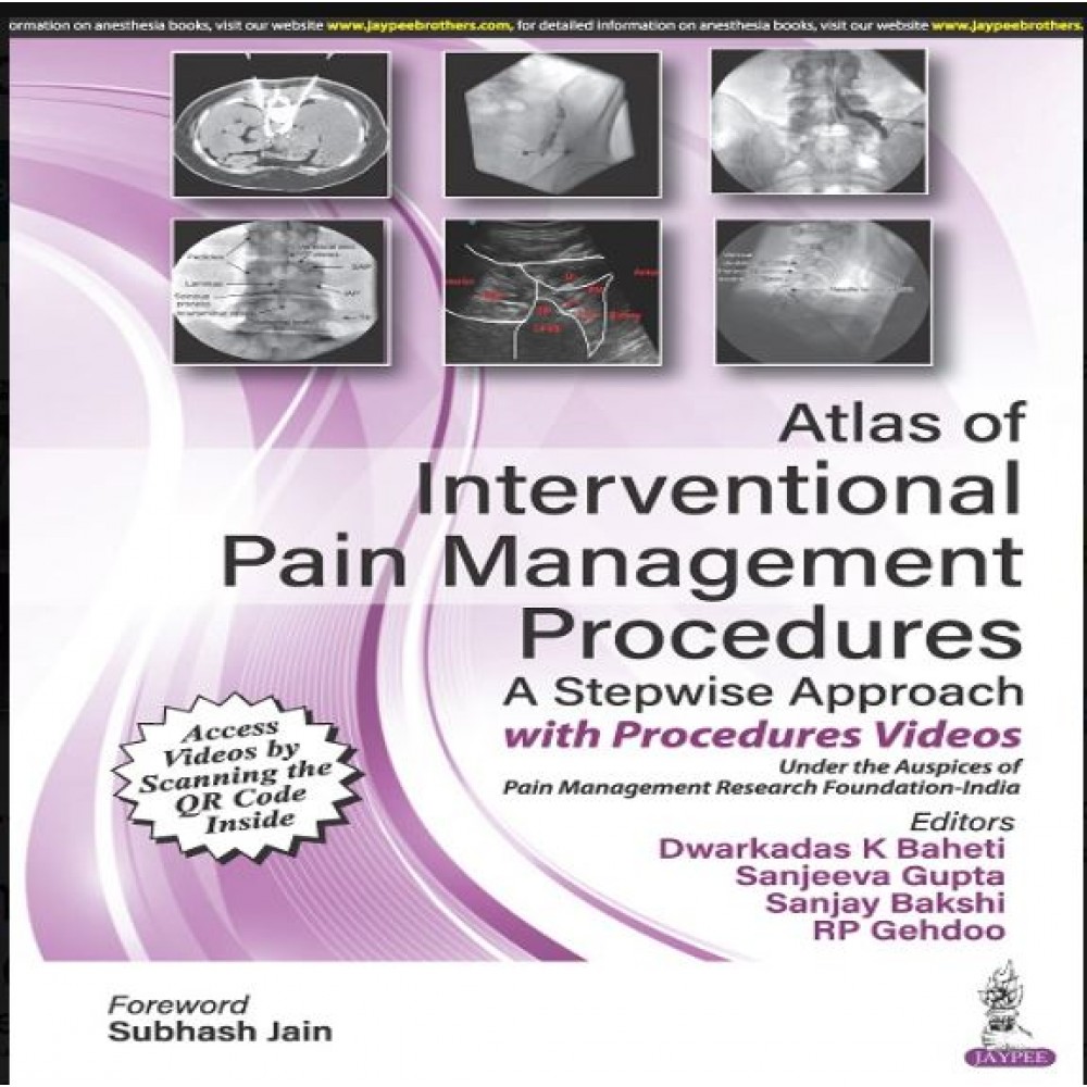 Atlas of Interventional Pain Management Procedures: A Stepwise Approach ...