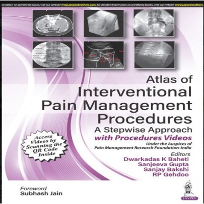 Atlas Of Interventional Pain Management Procedures: A Stepwise Approach 