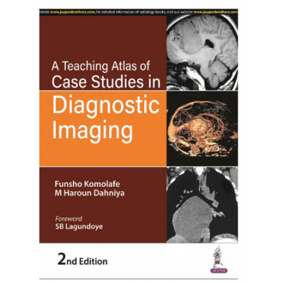 A Teaching Atlas of Case Studies in Diagnostic Imaging;2nd Edition 2023 by Funsho Komolafe 