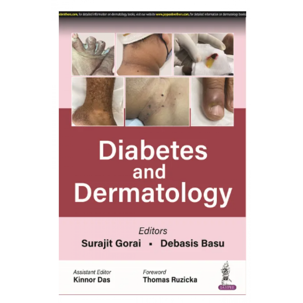 Diabetes and Dermatology;1st Edition 2023 By Surajit Gorai & Debasis Basu