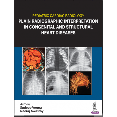 Pediatric Cardiac Radiology Plain Radiographic Interpretation in Congenital and Structural Heart Diseases;1st Edition 2024 by Sudeep Verma & Neeraj Awasthy