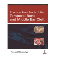 Practical Handbook of the Temporal Bone and Middle Ear Cleft;1st Edition 2023 by Neena H Bhalodiya