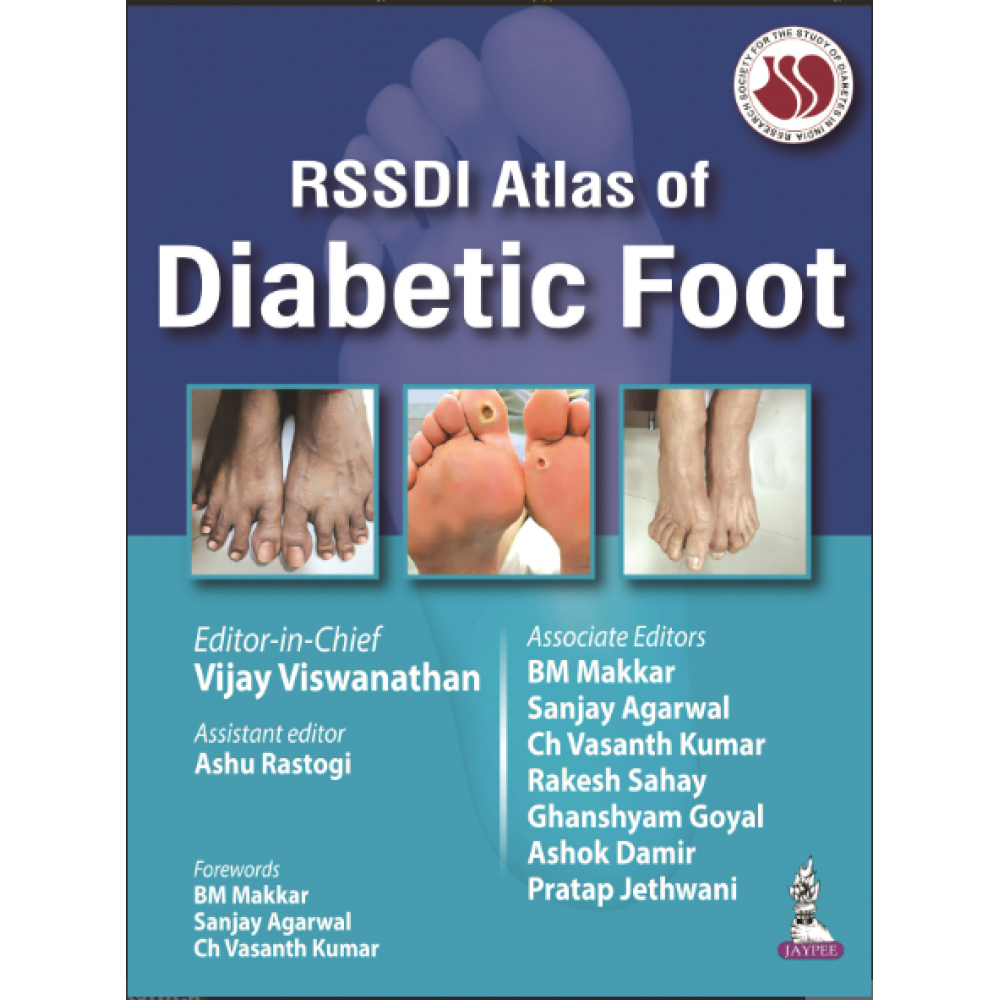 RSSDI Atlas of Diabetic Foot;1st Edition 2024 by Vijay Viswanathan & Ashu Rastogi