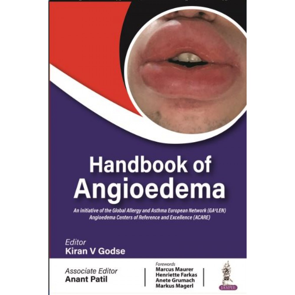 Handbook of Angioedema:1st Edition 2024 By Kiran V Godse & Anant Patil