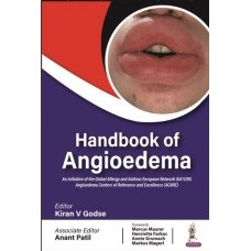 Handbook of Angioedema:1st Edition 2024 By Kiran V Godse & Anant Patil