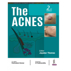 The Acnes;2nd Edition 2024 By Jayakar Thomas