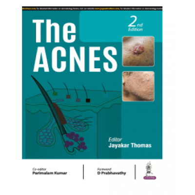 The Acnes;2nd Edition 2024 By Jayakar Thomas