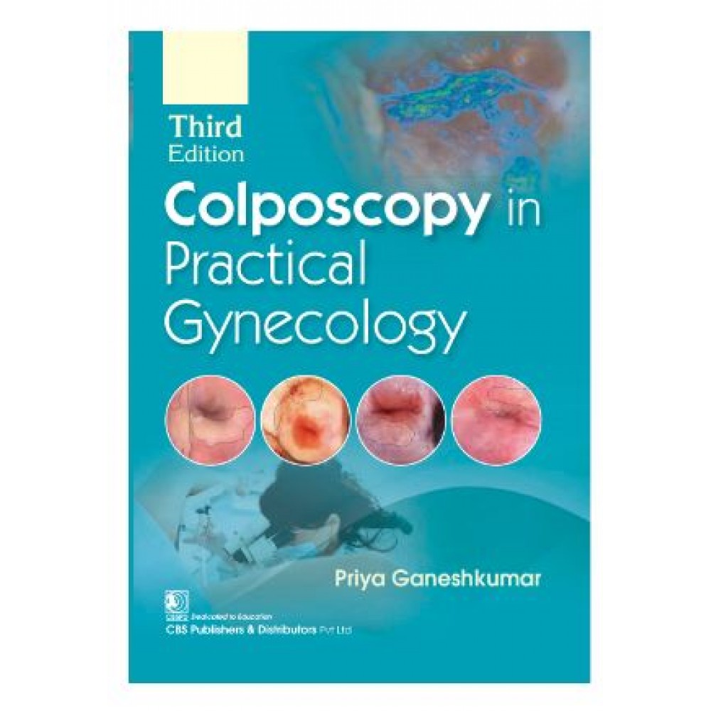 Colposcopy in Practical Gynecology;3rd Edition 2025 by Priya Ganeshkumar