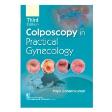 Colposcopy in Practical Gynecology;3rd Edition 2025 by Priya Ganeshkumar