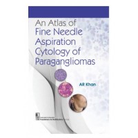 An Atlas of Fine Needle Aspiration Cytology of Paragangliomas;1st Edition 2024 by AR Khan 