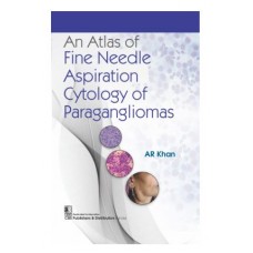 An Atlas of Fine Needle Aspiration Cytology of Paragangliomas;1st Edition 2024 by AR Khan 