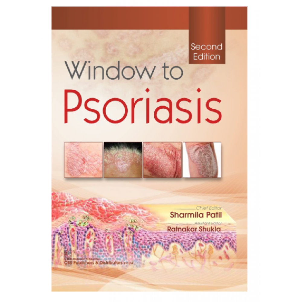 Window to Psoriasis;2nd Edition 2022 by Sharmila Patil & Ratnakar Shukla