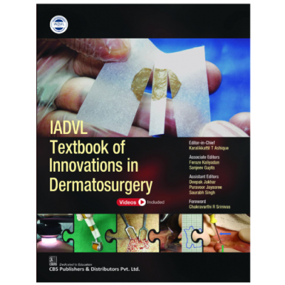 IADVL Textbook of Innovations in Dermatosurgery;1st Edition 2022 by Karalikkattil T Ashique, Feroze Kaliyadan & Sanjeev Gupta