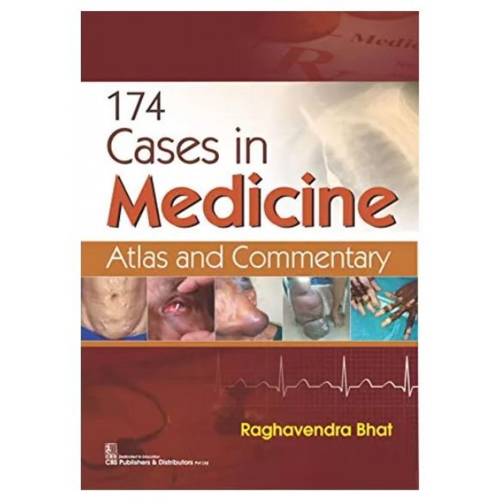 174 Cases In Medicine:Atlas And Commentary;1st Edition 2021 By Raghavendra Bhat