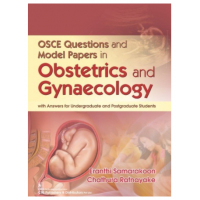 OSCE Questions and Model papers in Obstetrics and Gynecology;1st Edition 2019 By Eranthi Samarakoon & Chathura Ratnayake