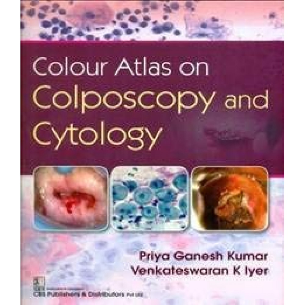 Colour Atlas On Colposcopy And Cytology;1st Edition 2020 By Dr Priya Ganesh Kumar & Vekateswaran K Iyer