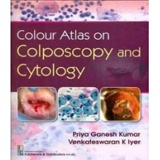 Colour Atlas On Colposcopy And Cytology;1st Edition 2020 By Dr Priya Ganesh Kumar & Vekateswaran K Iyer